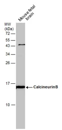 Anti-Calcineurin B antibody used in Western Blot (WB). GTX114181